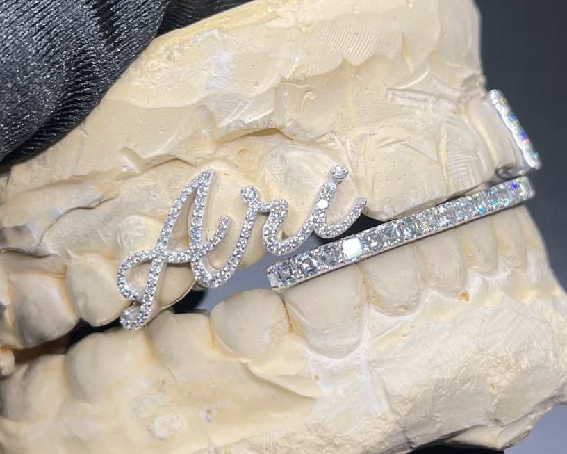07 Ari Custom Asscher Cut Grillz