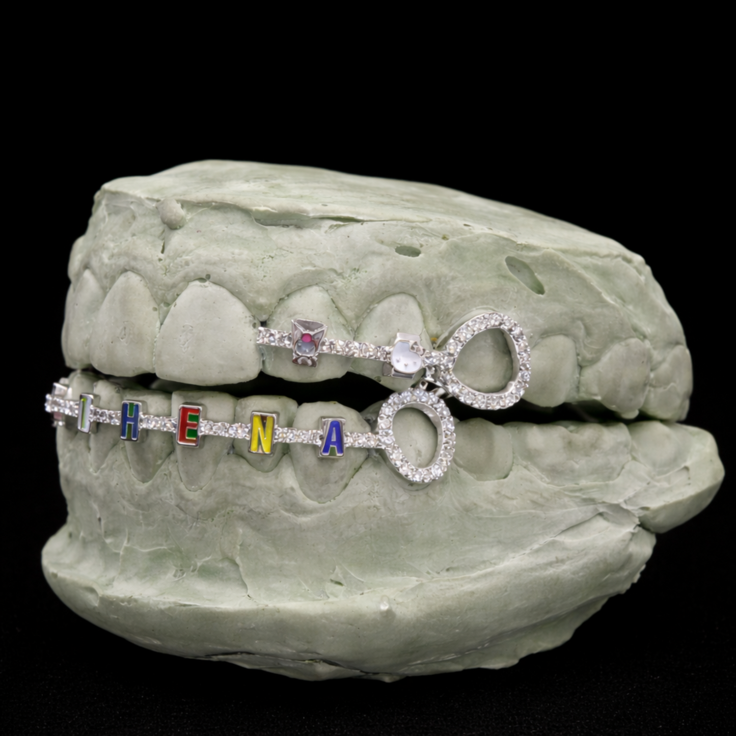 Custom Braces