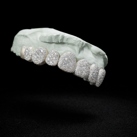 Full Bussdown Grillz