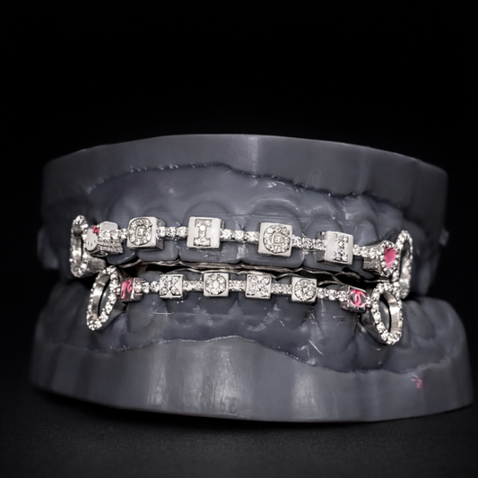 Custom GIGI Braces Grillz